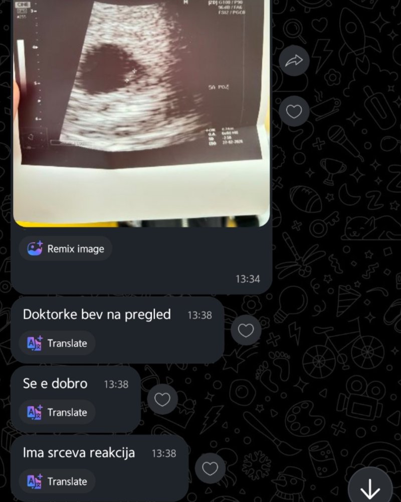 Ехо